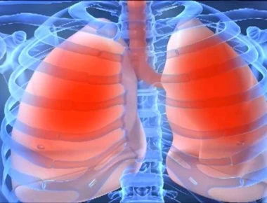 Βρογχίτιδα: Τι θα νιώσετε στα πρώιμα συμπτώματα – Η σωστή αντιμετώπιση για όλους